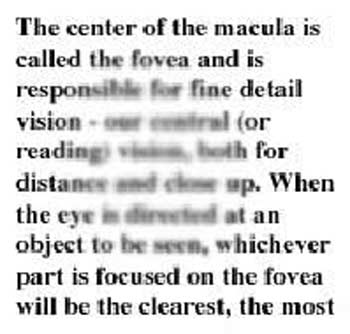 Macular Degeneration